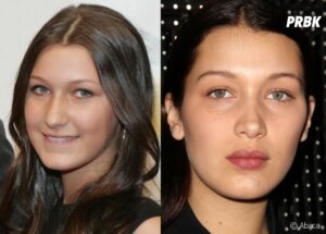 bella Hadid avant apres